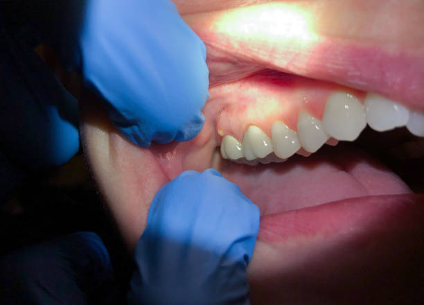 Best Weekend Emergency Dentist in Pine Mountain, GA