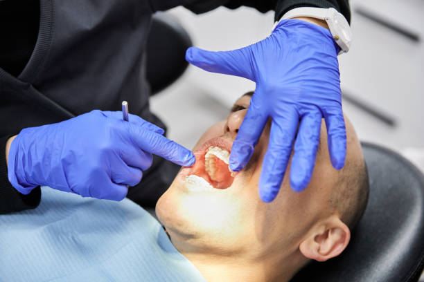 Best Emergency Broken Tooth Repair in Pine Mountain, GA